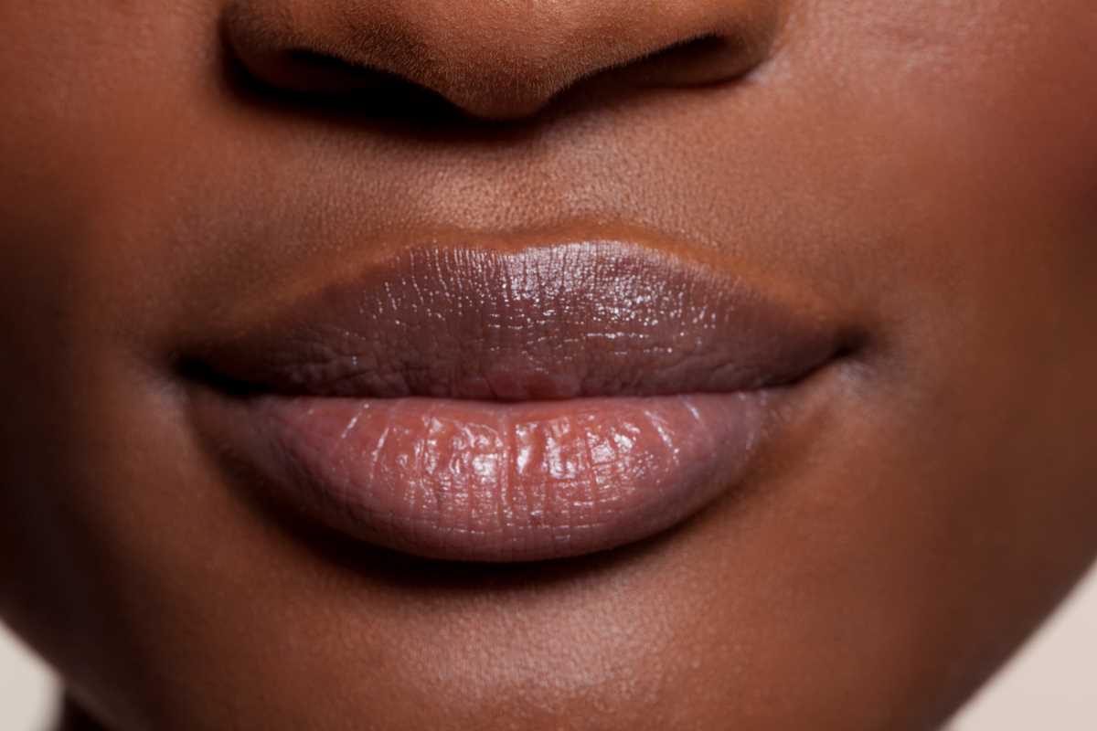 Surprising Causes of Chapped Lips and How to Avoid Them